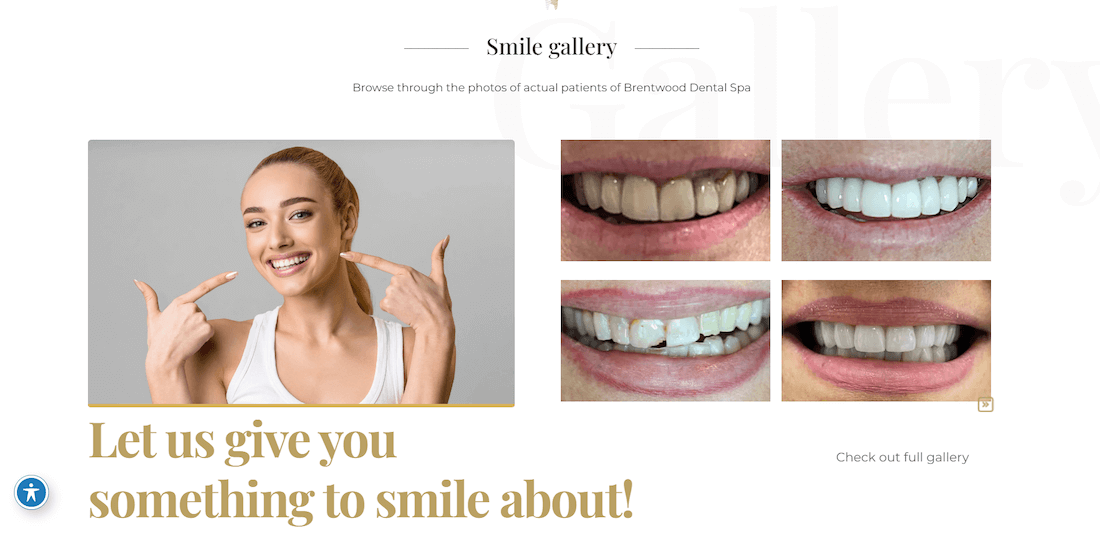Brentwood Dentwood Spa - Dental Website Examples
